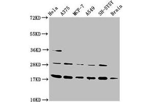 Western Blot Positive WB detected in: Hela whole cell lysate, A375 whole cell lysate, MCF-7 whole cell lysate, A549 whole cell lysate, SH-SY5Y whole cell lysate, Rat brain tissue All lanes: DAZAP2 antibody at 3. (DAZAP2 antibody  (AA 1-168))
