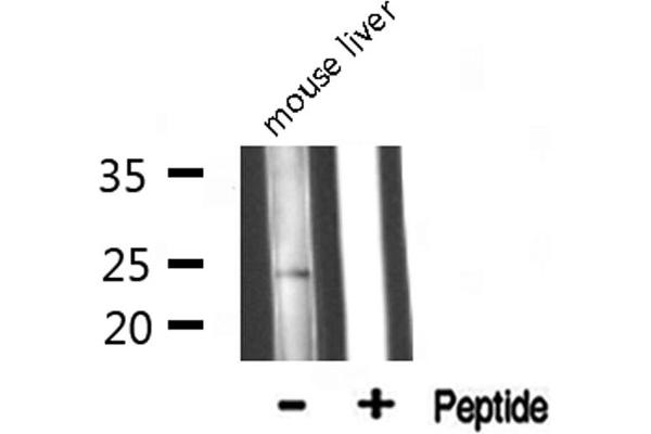 MRPL13 抗体  (C-Term)