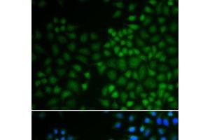 Immunofluorescence analysis of U2OS cells using NR0B2 Polyclonal Antibody
