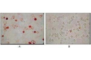 Immunocytochemistry analysis of TPA induced BCBL-1 cells (A) and uninduced BCBL-1 cells (B) using KSHV ORF62 mouse mAb with AEC staining. (KSHVORF62 antibody)