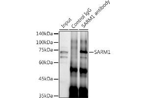 Immunoprecipitation analysis of 300 μg extracts of SH-SY5Y cells using 3 μg S antibody (ABIN7270591). (SARM1 antibody)