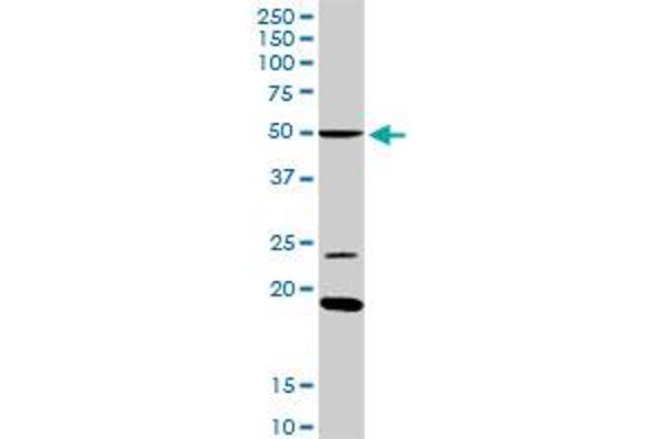 ISL2 anticorps  (AA 1-359)