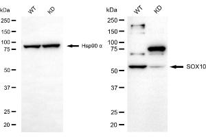 Western blotting analysis using SOX10 antibody (ABIN7800972).