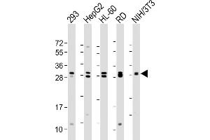 All lanes : Anti-EIF4E2 Antibody at 1:2000 dilution Lane 1: 293 whole cell lysate Lane 2: HepG2 whole cell lysate Lane 3: HL-60 whole cell lysate Lane 4: RD whole cell lysate Lane 5: NIH/3T3 whole cell lysate Lysates/proteins at 20 μg per lane. (EIF4E2 antibody)