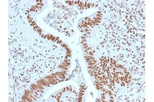 Immunohistochemistry (IHC) image for anti-Nucleophosmin (Nucleolar phosphoprotein B23, Numatrin) (NPM1) (AA 185-287) antibody (ABIN6940216)