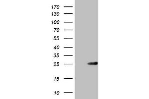 Western Blotting (WB) image for anti-ATP-Binding Cassette, Sub-Family C (CFTR/MRP), Member 5 (ABCC5) antibody (ABIN2715613) (ABCC5 antibody)