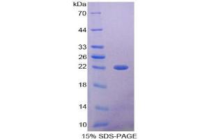SDS-PAGE (SDS) image for alpha 1 Microglobulin/bikunin precursor (AMBP) ELISA Kit (ABIN6574148)