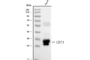 Western blot analysis of CD74 using anti-CD74 antibody (ABIN7602385).