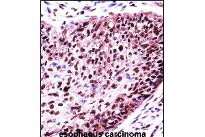Immunohistochemistry (Paraffin-embedded Sections) (IHC (p)) image for anti-Splicing Factor 3b, Subunit 1, 155kDa (SF3B1) (AA 374-402), (N-Term) antibody (ABIN657676)