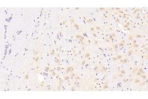 Detection of CXCL1 in Human Cerebrum Tissue using Polyclonal Antibody to Chemokine (C-X-C Motif) Ligand 1 (CXCL1) (CXCL1 antibody  (AA 35-107))