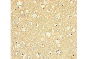 Immunohistochemistry of paraffin-embedded human brain tissue using ABIN7174125 at dilution of 1:100 (SIRPA antibody  (AA 31-373))
