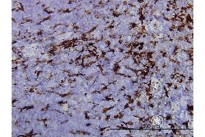 Immunoperoxidase of monoclonal antibody to GSN on formalin-fixed paraffin-embedded human tonsil. (Gelsolin antibody  (AA 673-782))