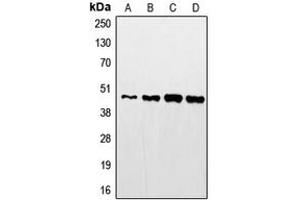 Western blot analysis of STAC2 expression in HeLa (A), mouse kidney (B), rat kidney (C), A431 (D) whole cell lysates.