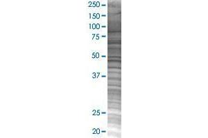 NLRP3 293T Cell Transient Overexpression Lysate(Denatured)