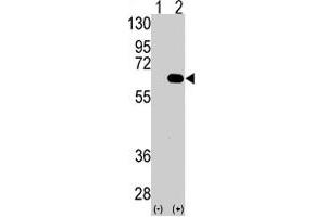 Western blot analysis of AMFR (arrow) using AMFR polyclonal antibody . (AMFR antibody  (AA 571-601))