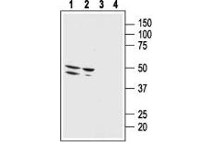 Western blot analysis of human malignant melanoma cell line Malme-3M (lanes 1 and 3) and human normal skin fibroblast cell line Malme-3 (lanes 2 and 4):1,2. (Bombesin Receptor 3 Peptide)
