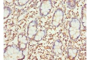 Immunohistochemistry of paraffin-embedded human small intestine tissue using ABIN7154604 at dilution of 1:100 (SAR1A antibody  (AA 1-198))