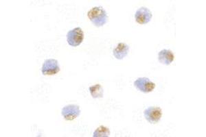 Immunocytochemistry of TLR1 in Daudi with this product at 10 μg/ml.