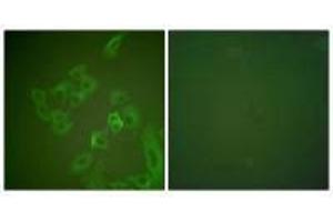 Immunofluorescence analysis of A549 cells, using Synuclein β antibody. (beta Synuclein antibody)
