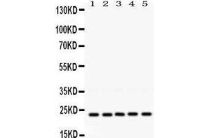 Western Blotting (WB) image for anti-RAB18, Member RAS Oncogene Family (RAB18) (AA 156-192), (C-Term) antibody (ABIN3043365) (RAB18 antibody  (C-Term))