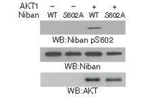 Western blot analysis in vitro kinase assays were performed by mixing purified bacterially expressed WT His-Niban or the His-Niban S602A with or without purified active AKT1 using Niban (Phospho-Ser602) Antibody. (Niban antibody  (pSer602))