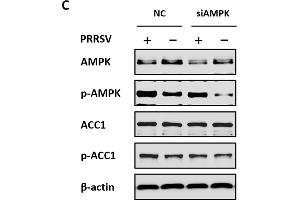 Acetyl-CoA carboxylase 1 (ACC1) activity is regulated by AMPK during PRRSV infection. (Acetyl-CoA Carboxylase alpha antibody  (pSer79))
