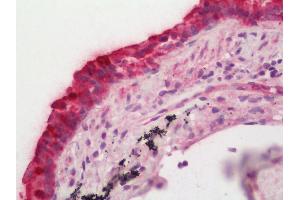 Human Lung: Formalin-Fixed, Paraffin-Embedded (FFPE). (FPGT antibody  (FITC))