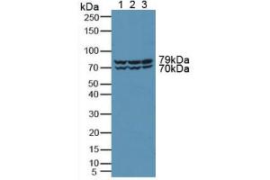 Figure. (PKD2 antibody  (AA 621-832))