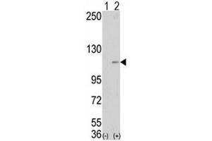Western blot analysis of LSD1 antibody and 293 cell lysate (2 ug/lane) either nontransfected (Lane 1) or transiently transfected with the AOF2 gene (2). (LSD1 antibody  (AA 457-490))