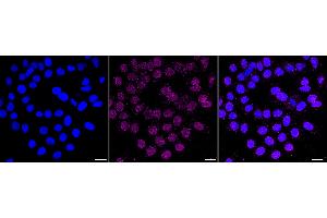 Immunocytochemical staining of HepG2 cells with Histone H2B (crotonyl K12) antibody (ABIN7798945), 1:1,000). (Recombinant Histone H2B antibody  (H2BK12cr))