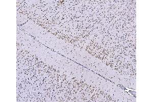 IHC analysis of FOXK1 using anti-FOXK1 antibody (ABIN7600295). (Foxk1 antibody  (AA 175-671))