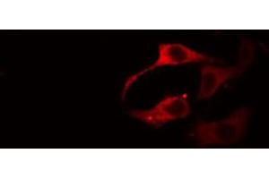 Immunofluorescence (fixed cells) (IF/ICC) image for anti-Sodium Potassium ATPase, alpha1 (ATP1A1) (pSer16) antibody (ABIN6256160)