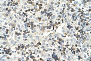 Image no. 1 for anti-Hydroxysteroid (17-Beta) Dehydrogenase 6 (HSD17B6) (N-Term) antibody (ABIN204970) (HSD17B6 antibody  (N-Term))