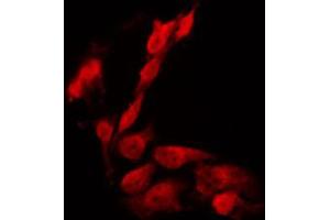 ABIN6266703 staining HeLa by IF/ICC. (PHF1 antibody  (Internal Region))