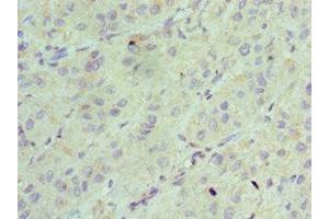 Immunohistochemistry of paraffin-embedded human liver tissue using ABIN7143342 at dilution of 1:100 (Adenylate Kinase 2 antibody  (AA 1-232))