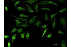 Immunofluorescence of monoclonal antibody to DMP1 on HeLa cell. (DMP1 antibody  (AA 221-330))