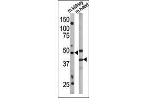 The anti-G4A Pab 1808a is used in Western blot to detect G4A in mouse kidney (left) and mouse heart (right) tissue lysates