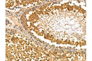 ABIN6259183 and ABIN6275173 at 1/100 staining Rat testis tissue by IHC-P.