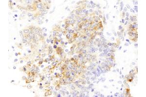 Immunohistochemistry (IHC) image for anti-Drebrin 1 (DBN1) (AA 599-649) antibody (ABIN7453432)