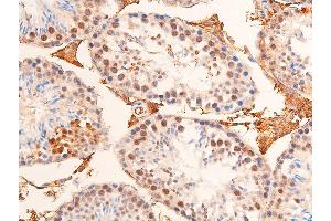 ABIN6267073 at 1/100 staining mouse testicular tissue sections by IHC-P. (CHEK1 antibody  (pSer280))