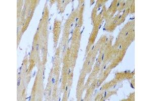 Immunohistochemistry of paraffin-embedded Rat heart using IGF2BP3 Polyclonal Antibody at dilution of 1:100 (40x lens). (IGF2BP3 antibody)
