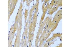 Immunohistochemistry of paraffin-embedded Rat heart using IGF2BP3 Polyclonal Antibody at dilution of 1:100 (40x lens).