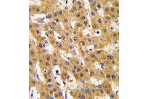 Image no. 3 for anti-Pyruvate Dehydrogenase Complex, Component X (PDHX) antibody (ABIN357415) (PDHX antibody)