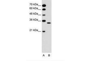 Image no. 1 for anti-Olfactory Receptor, Family 5, Subfamily T, Member 2 (OR5T2) (C-Term) antibody (ABIN6736622)