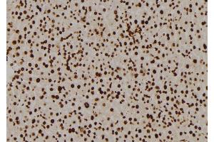 ABIN6276993 at 1/100 staining Mouse liver tissue by IHC-P. (RPL5 antibody  (Internal Region))