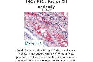 Image no. 1 for anti-Coagulation Factor XII (F12) antibody (ABIN1734212) (F12 antibody)
