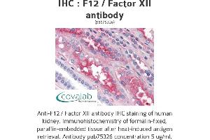 Image no. 1 for anti-Coagulation Factor XII (F12) antibody (ABIN1734212) (F12 antibody)