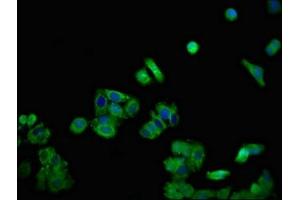 Immunofluorescent analysis of HepG2 cells using ABIN7149775 at dilution of 1:100 and Alexa Fluor 488-congugated AffiniPure Goat Anti-Rabbit IgG(H+L) (Desmoglein 1 antibody  (AA 384-539))