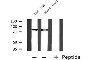 Western blot analysis of extracts from mouse heart and rat lung, using PRMT7 Antibody. (PRMT7 antibody  (Internal Region))