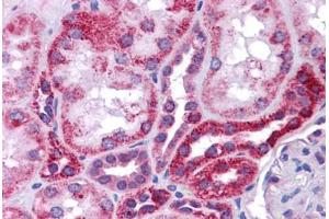 Human Kidney: Formalin-Fixed, Paraffin-Embedded (FFPE) (p53 antibody  (N-Term))